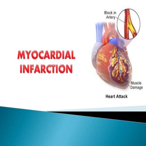 Myocardial Infarction 