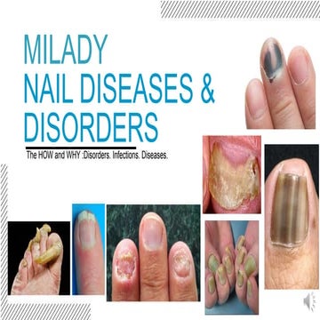 Milady nail disease and disorder Lecture