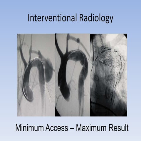 Minimum Access Maximum Result | PPTX