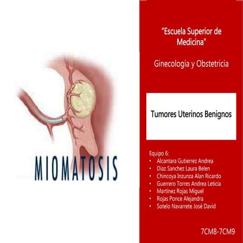 Tumores Uterinos Benignos 