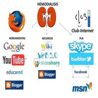 Mi pln de hemodialisis