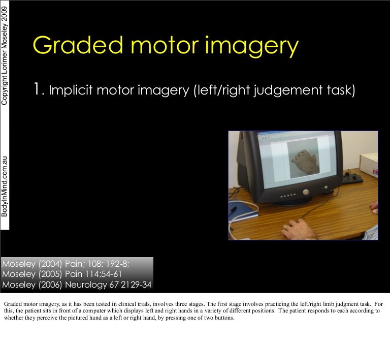 Graded Motor Imagery for Chronic Pain