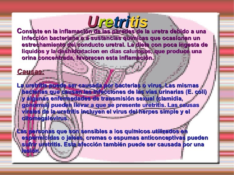 uretritis por herpex simple uretritis por herpex simple