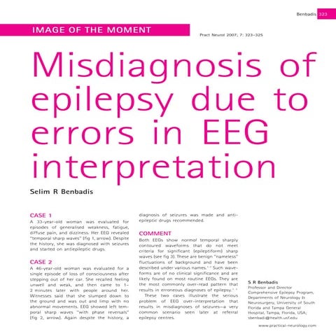 Misdiagnosis of epilepsy due to errors in eeg interpretation