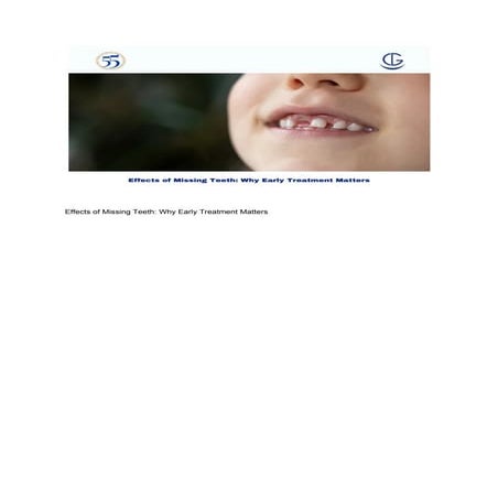 Understanding the Effects of Missing Teeth on Oral Health and Overall ...
