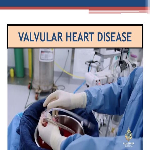 Mitral valve disease 2020 | PPT