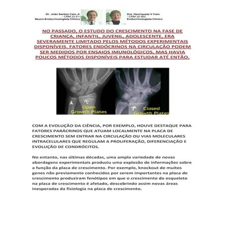 Múltiplos caminhos para o crescimento da altura normal de criança, infantil, ...