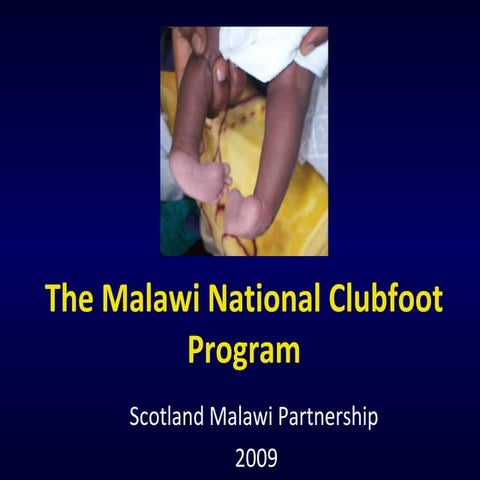 Club foot | PPTX