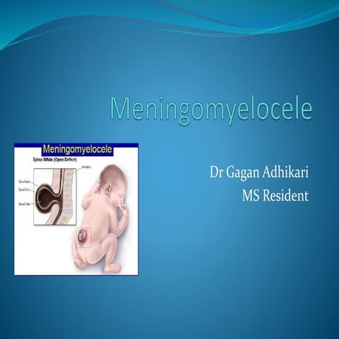 Meningiomyleocele | PPTX