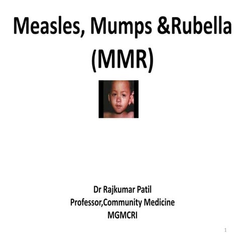MEASLES, MUMPS & RUBELLA