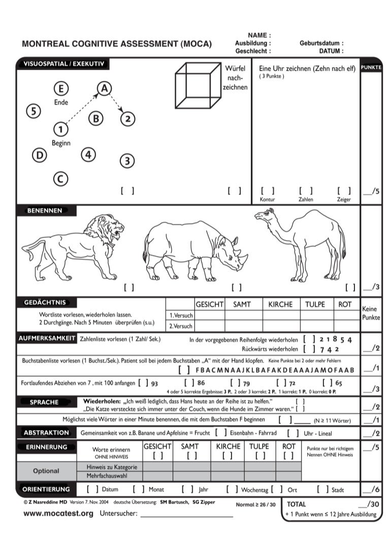 moca assessment moca assessment