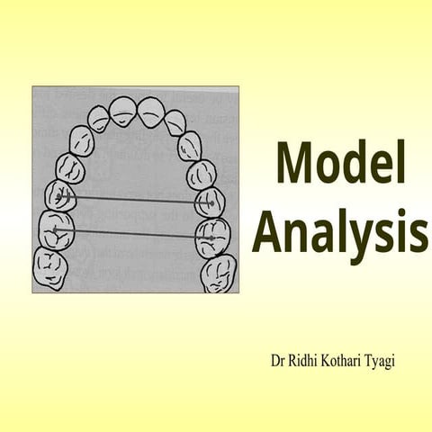 Model analysis in orthodontics presentation