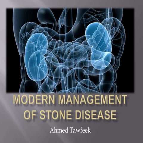 Modern management of stone disease