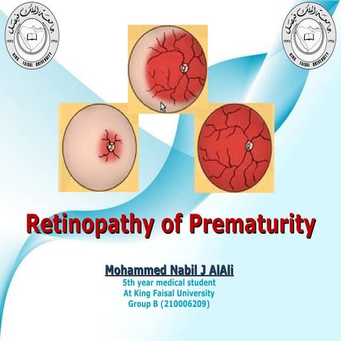 retinopathy of prematurity