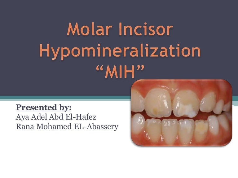 Molar incisor hypomineralization