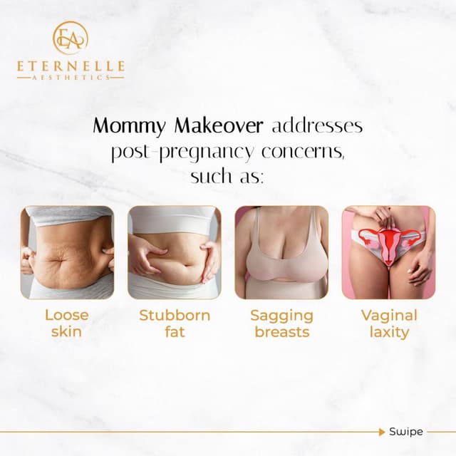 Mommy Makeover Cost in Hyderabad | Best Plastic Surgeon