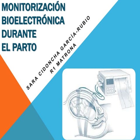 Monitorizacion bioelectronica intraparto