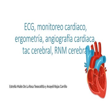 monitoreo cardiaco  para enfermero .pptx