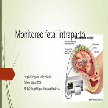 Monitoreo fetal intraparto