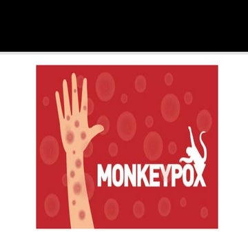 Monkey Pox Virus | PPTX