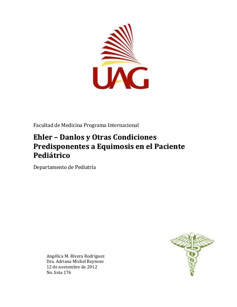 causas equimosis ocular