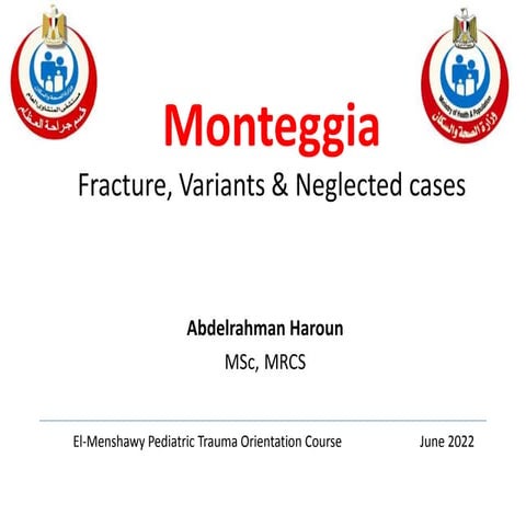 Monteggia.pptx