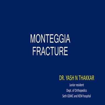 Monteggia fracture dislocation.pptx