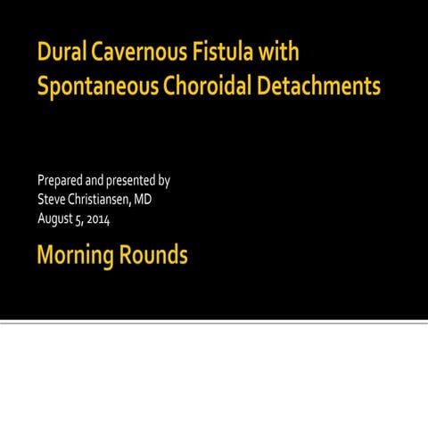 Dural cavernous fistula with spontaneous choroidal detachments
