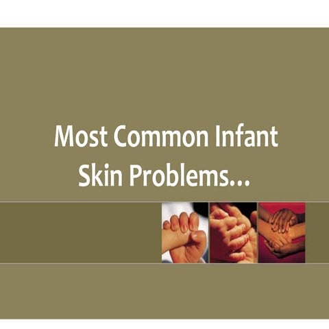 Diaper rashes | PPT