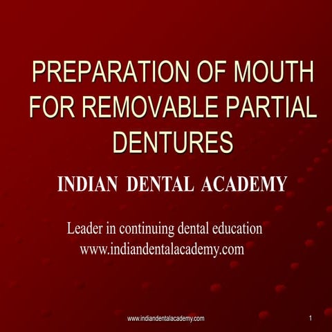 Mouth preparation for rpd /certified fixed orthodontic courses by Indian dent...