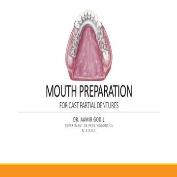 MOUTH PREPARATION IN CAST PARTIAL DENTURES
