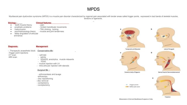 Myofacial pain dysfunction syndrome | PPTX | Dental Health | Diseases ...