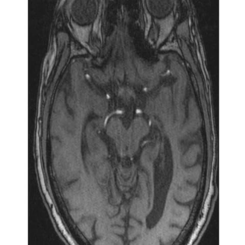 MRI in neck imaging | PPT
