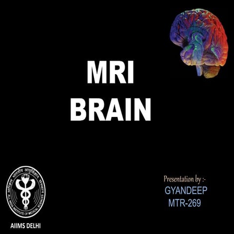 MRI BRAIN(AIIMS DELHI).pptx