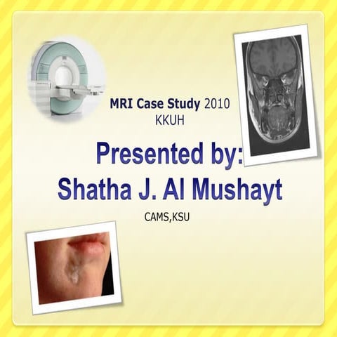 Mri case study- scleroderma