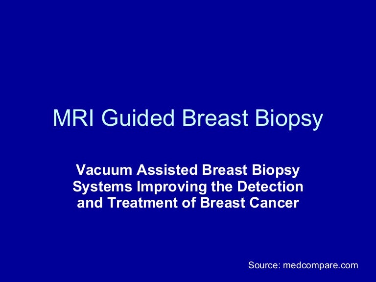 Mri Guided Breast Biopsy