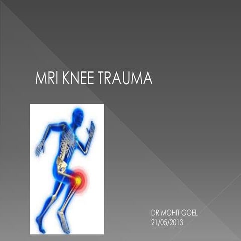 MRI Knee trauma