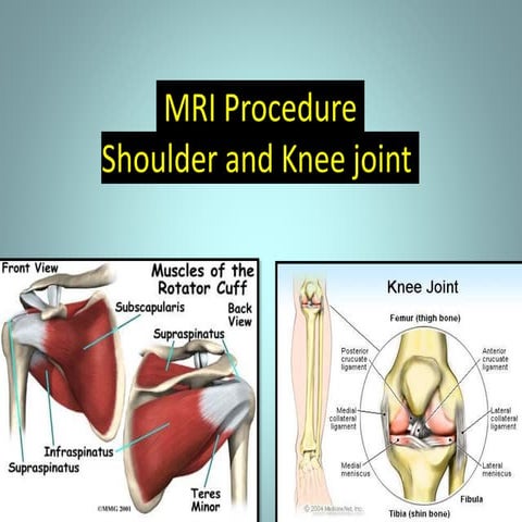 MRI shoulder and knee- Anatomy, Scan Planning & Its Techniques  