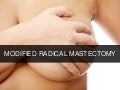 Modified Radical Masectomy
