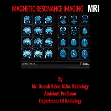 MR over view MR over view MR over view MR over view