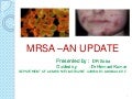 Signs And Symptoms of Mercer's Disease