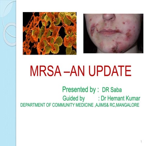 MRSA  AN UPDATE 
