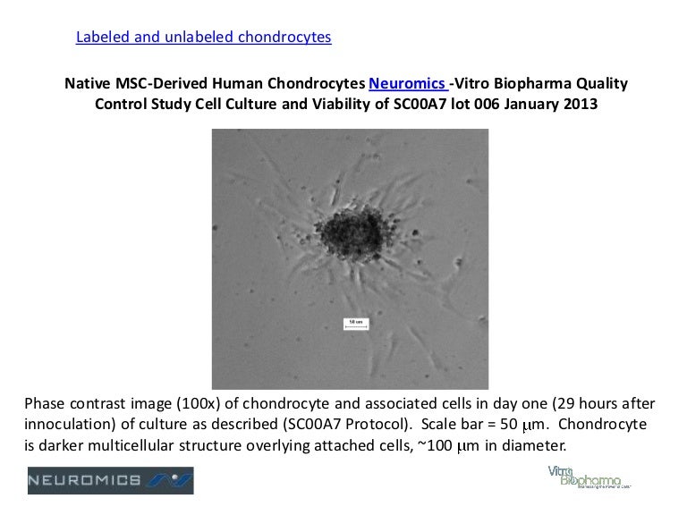 Msc derived human chondrocytes in culture-01-2013