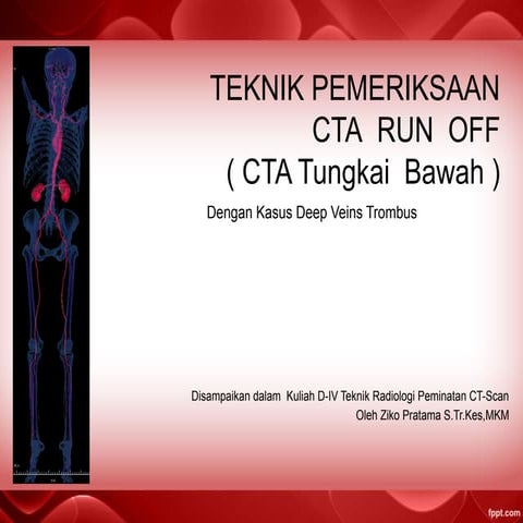 Comprehensive Guide to CTA Run Off for Lower Limb Vascular Assessment ...