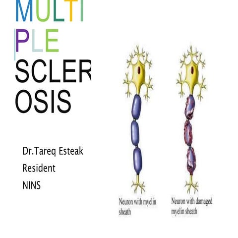 Multiple Sclerosis