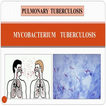 Mycobacterium tuberculosis