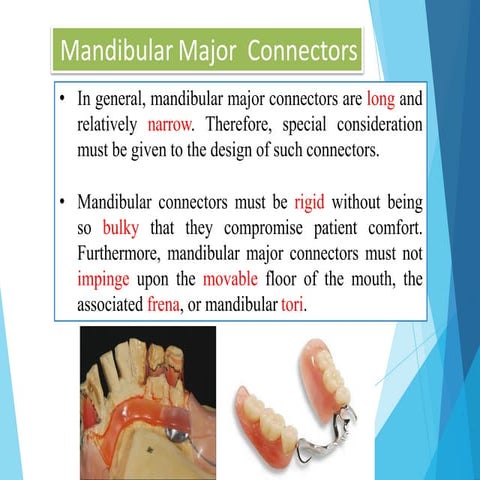 Mandibular Major Connectors | PDF