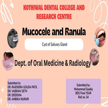 MUCOCELE & RANULA  are mucous cyst of salivary gland