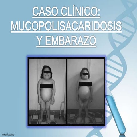 Mucopolisacaridosis