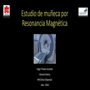 Resonancia Magnética muñeca